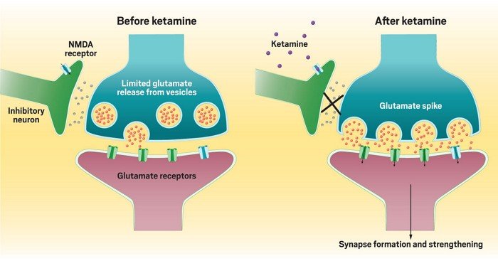 How Does Ketamine Work for Depression?